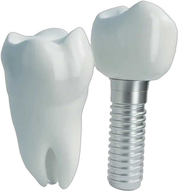 Blog New Horizon Institute Solid Png Dental Implant Icon