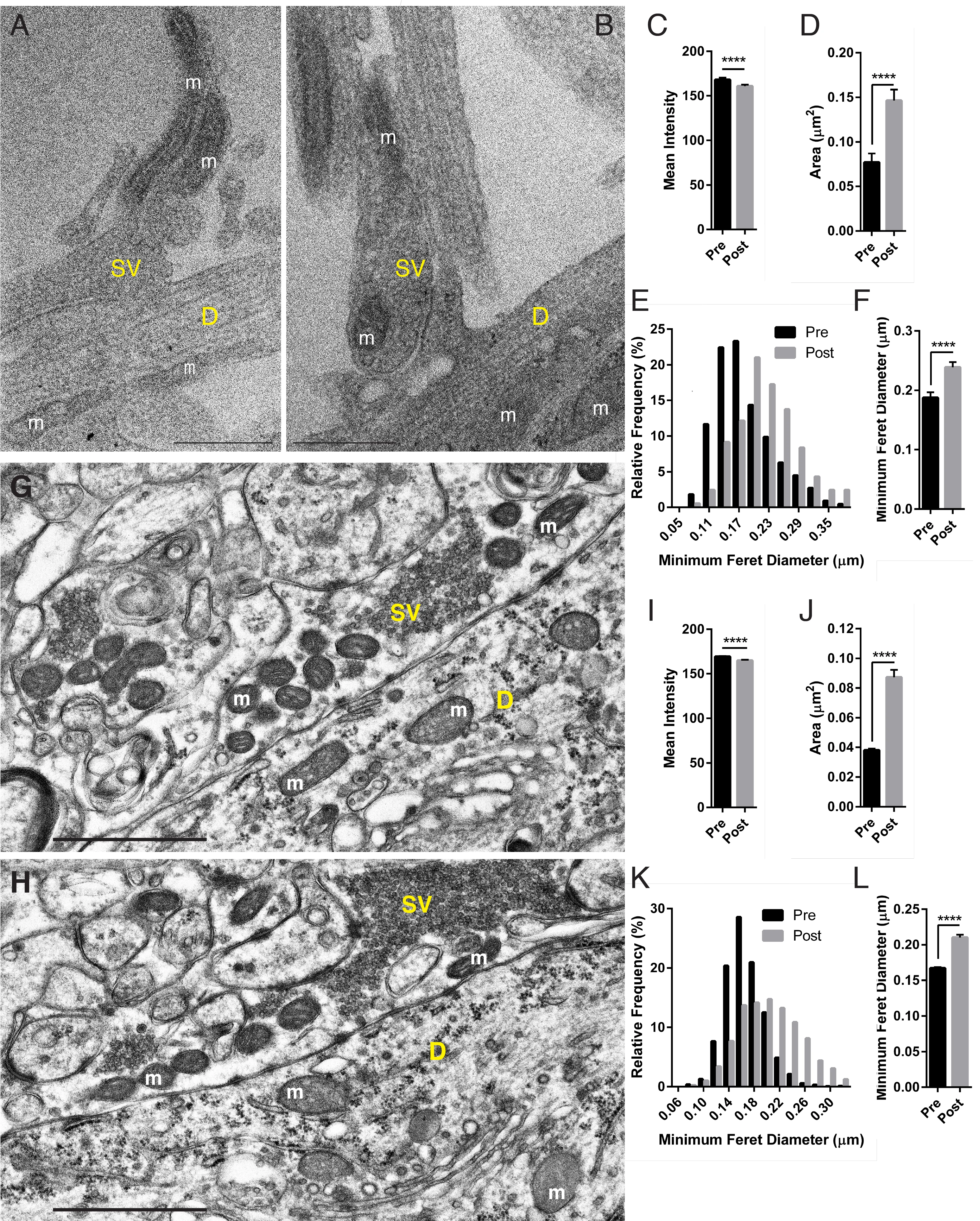 Mitochondria In Hippocampal Presynaptic Mitochondria In Synapse Electron Microscope Png Mitochondria Png