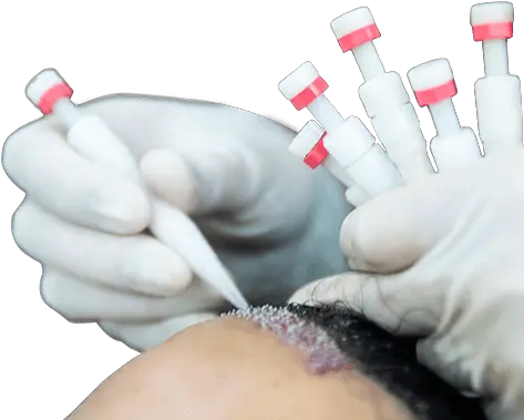 Dr Serkan Aygin Hair Transplant Clinic Turkey Hair Transplantation Png Master Hand Png