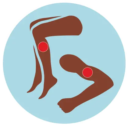 What To Know About Blood Clots If You Have Sickle Cell Massage Head Blood Clot Png Leg Pain Transparent Icon