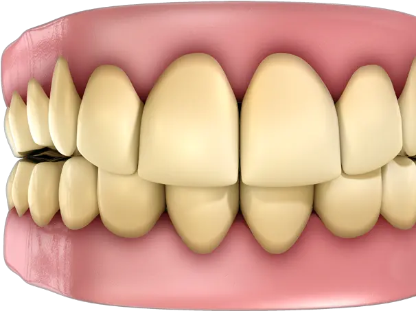 Stained Teeth Color Are Healthy Teeth Png Teeth Png