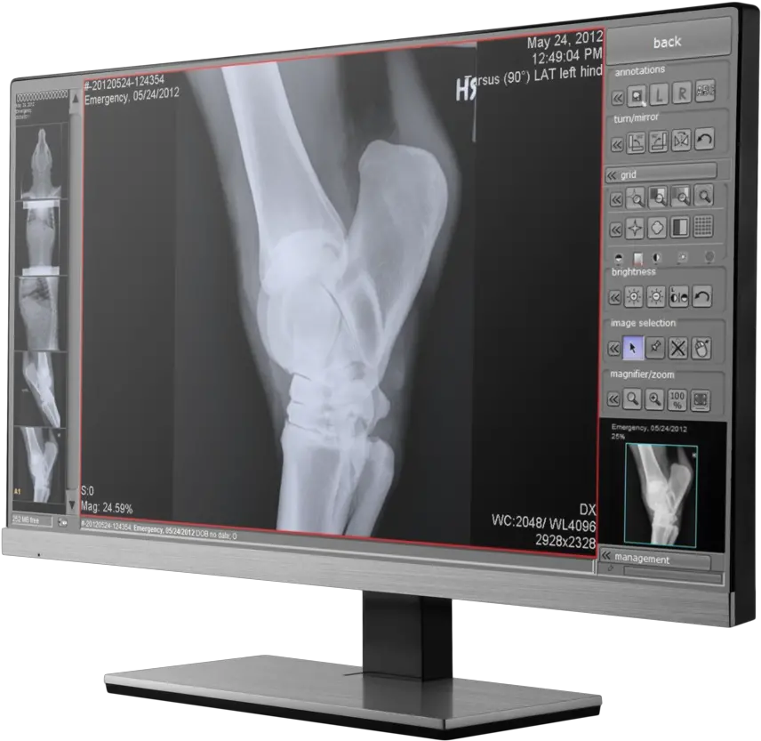 Veterinary X Ray Software U2014 Digital Xray Equipment Nuon Digital X Ray Acquisition Png X Ray Png