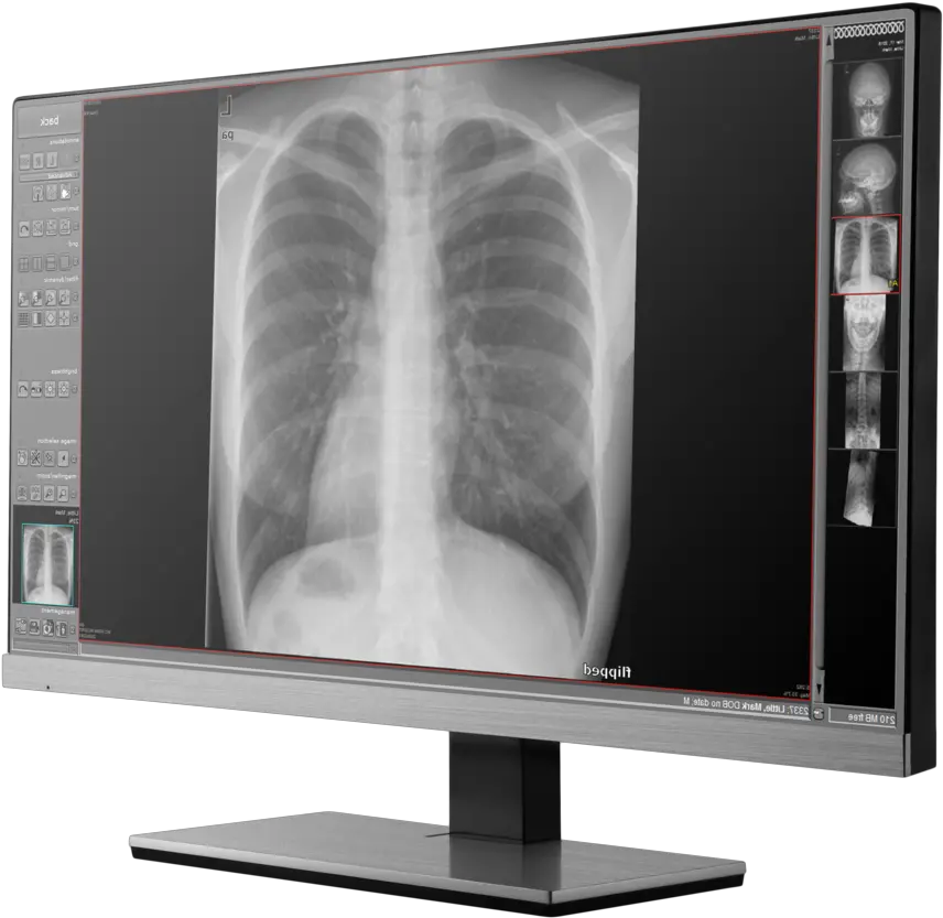 Human X Alberta X Ray Computer Program Png X Ray Png