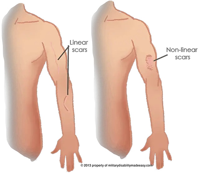 Index Of Png Scars