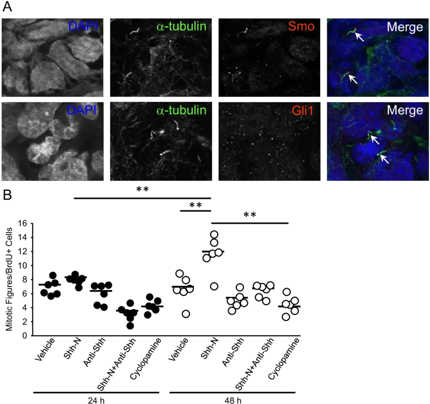 Primary Cilia Contain Shh Signaling Proteins And Drives Screenshot Png Shh Png