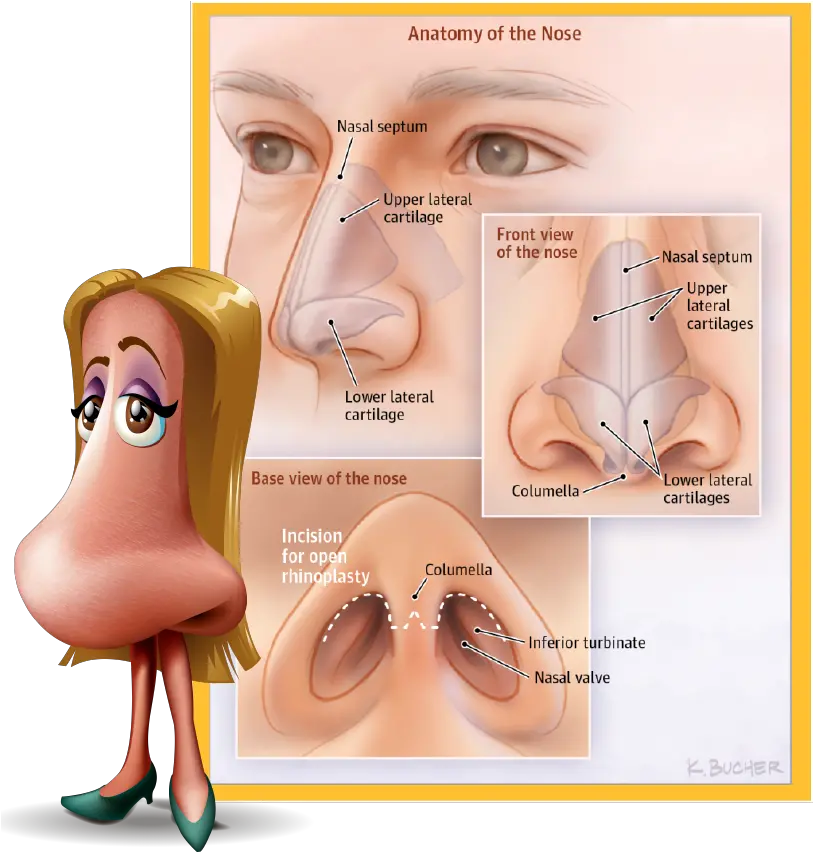 Download Rhinoplasty Commonly Known As Scar Tissue After Rhinoplasty Png Rudolph Nose Png