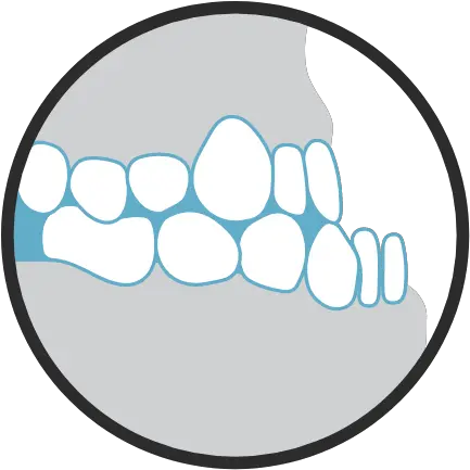 Orthodontic Conditions We Treat To Fix Your Bite Smile Houzz Language Png Dental Trauma Icon