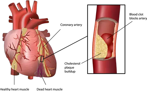 Enlisting Stem Cells In The War Oral Health And Heart Disease Png Heart Organ Png