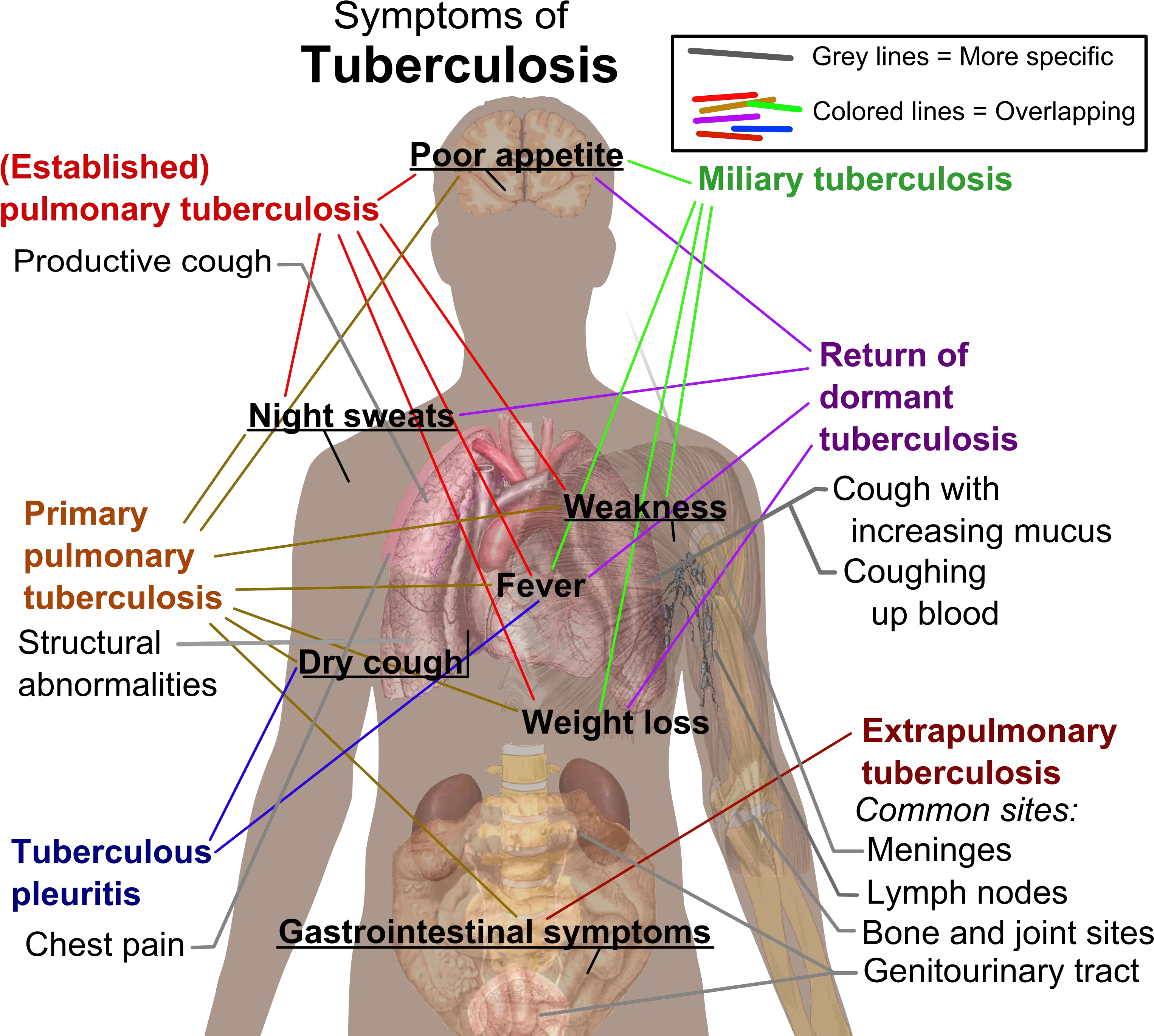 Tuberculosis Symptoms Tuberculosis Tests Png Action Lines Png